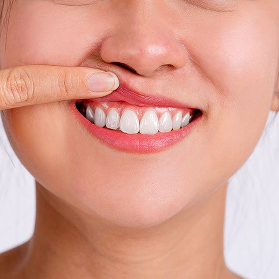 The Hills Dental Associates -